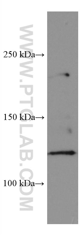 Western Blot (WB) analysis of HepG2 cells using SERCA2,ATP2A2 Monoclonal antibody (67248-1-Ig)