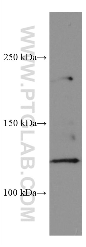 WB analysis of HepG2 using 67248-1-Ig