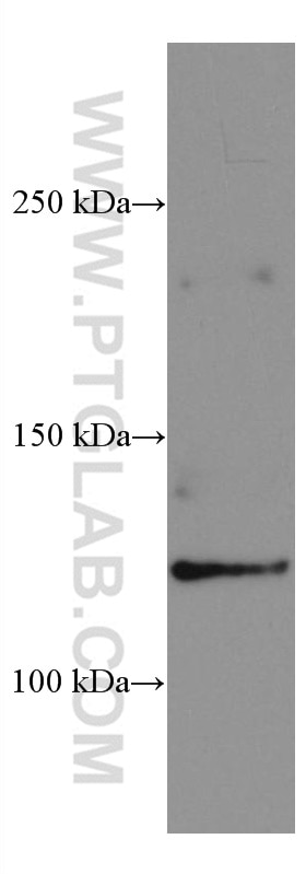 Western Blot (WB) analysis of MCF-7 cells using SERCA2,ATP2A2 Monoclonal antibody (67248-1-Ig)