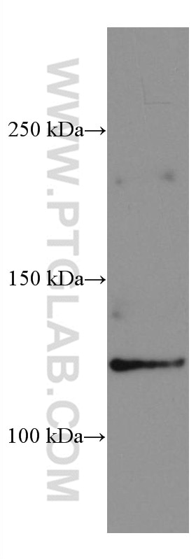 WB analysis of MCF-7 using 67248-1-Ig