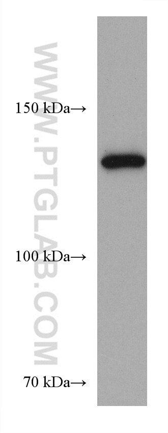 Western Blot (WB) analysis of HSC-T6 cells using SERCA2,ATP2A2 Monoclonal antibody (67248-1-Ig)