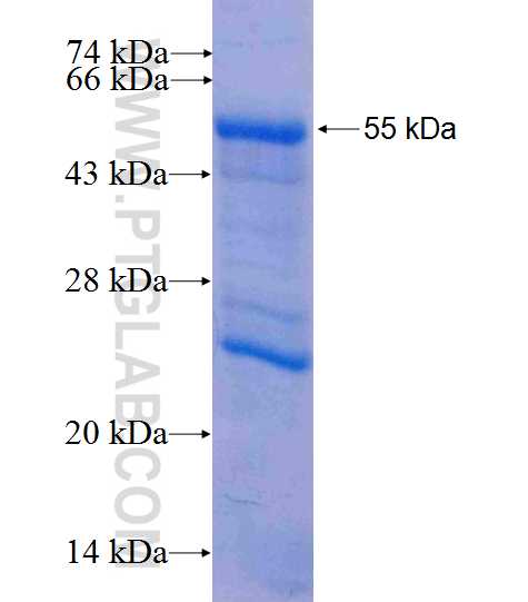 SERCA2,ATP2A2 fusion protein Ag26177 SDS-PAGE