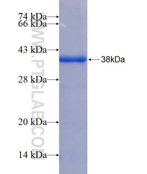 SERCA2,ATP2A2 fusion protein Ag26307 SDS-PAGE