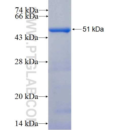 SERCA2,ATP2A2 fusion protein Ag5052 SDS-PAGE