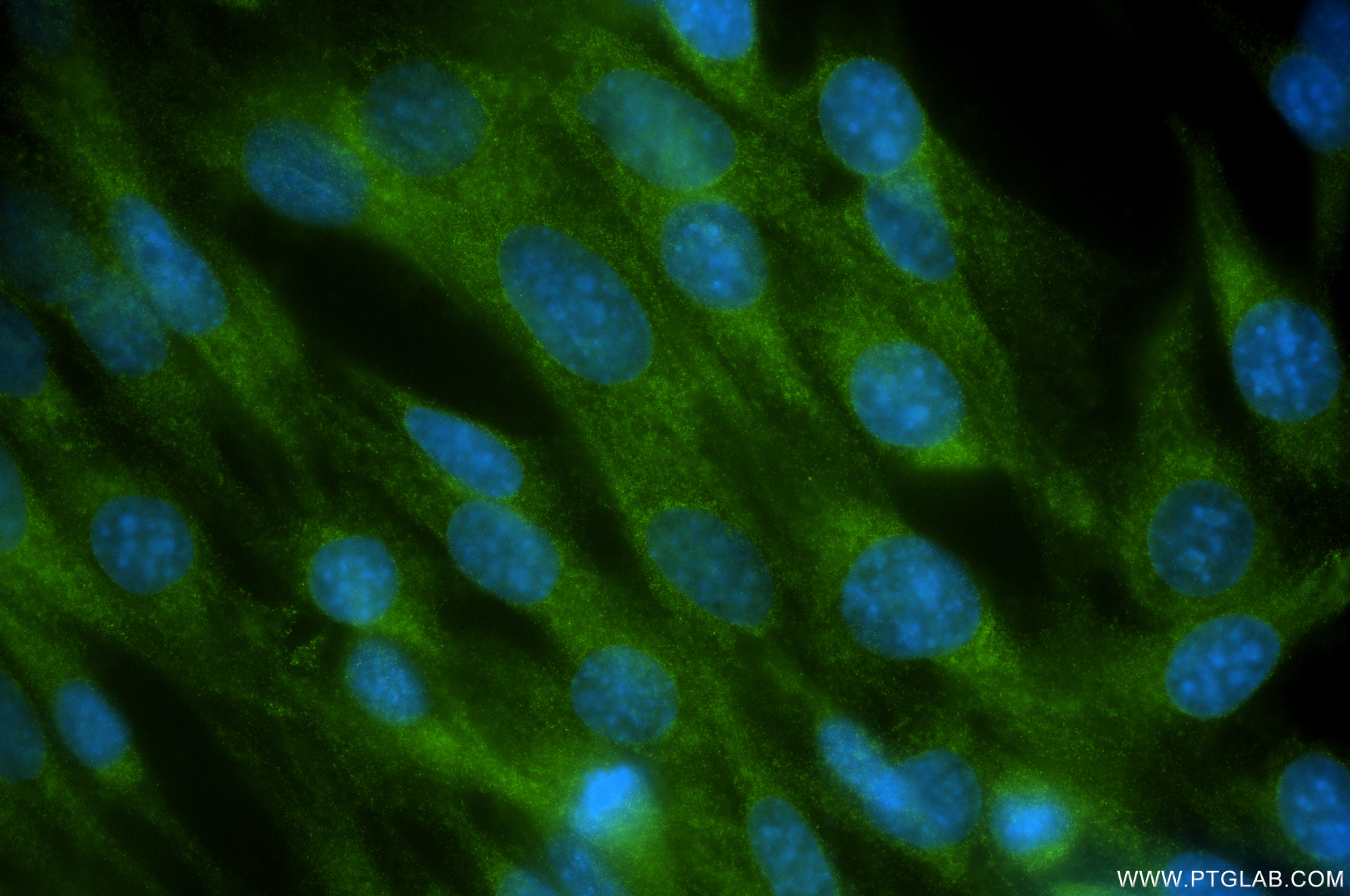 Immunofluorescence (IF) / fluorescent staining of C2C12 cells using SERCA2/ATP2A2 Recombinant antibody (86050-1-RR)