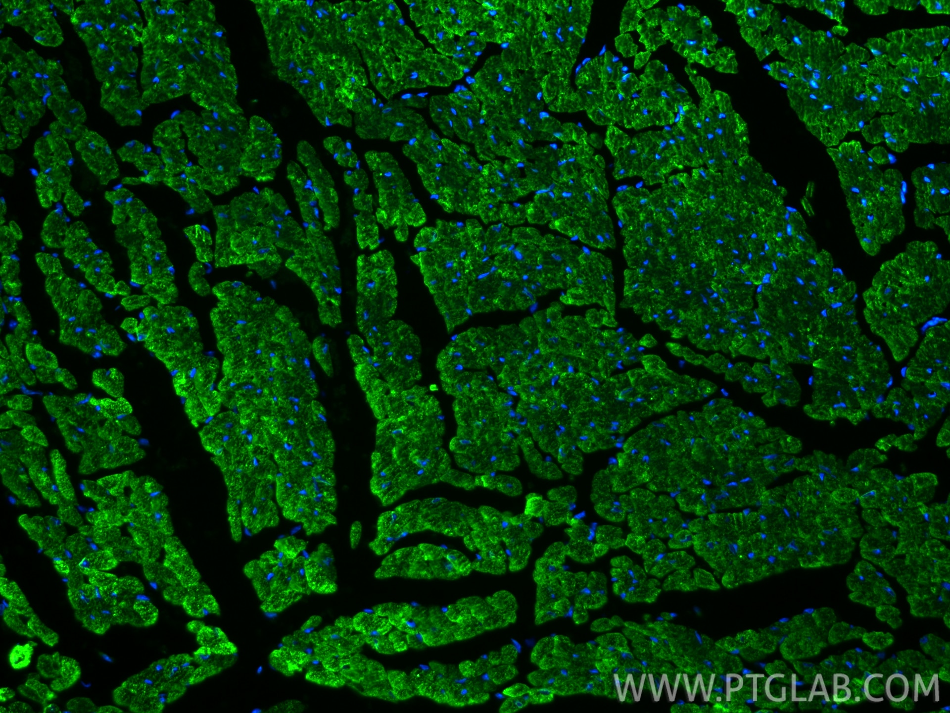 Immunofluorescence (IF) / fluorescent staining of mouse heart tissue using SERCA2/ATP2A2 Recombinant monoclonal antibody (86050-1-RR)