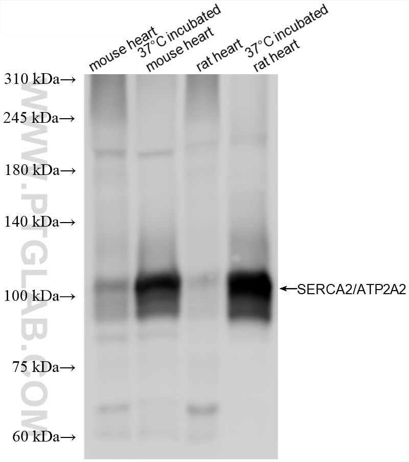 Western Blot (WB) analysis of various lysates using SERCA2/ATP2A2 Recombinant antibody (86050-1-RR)