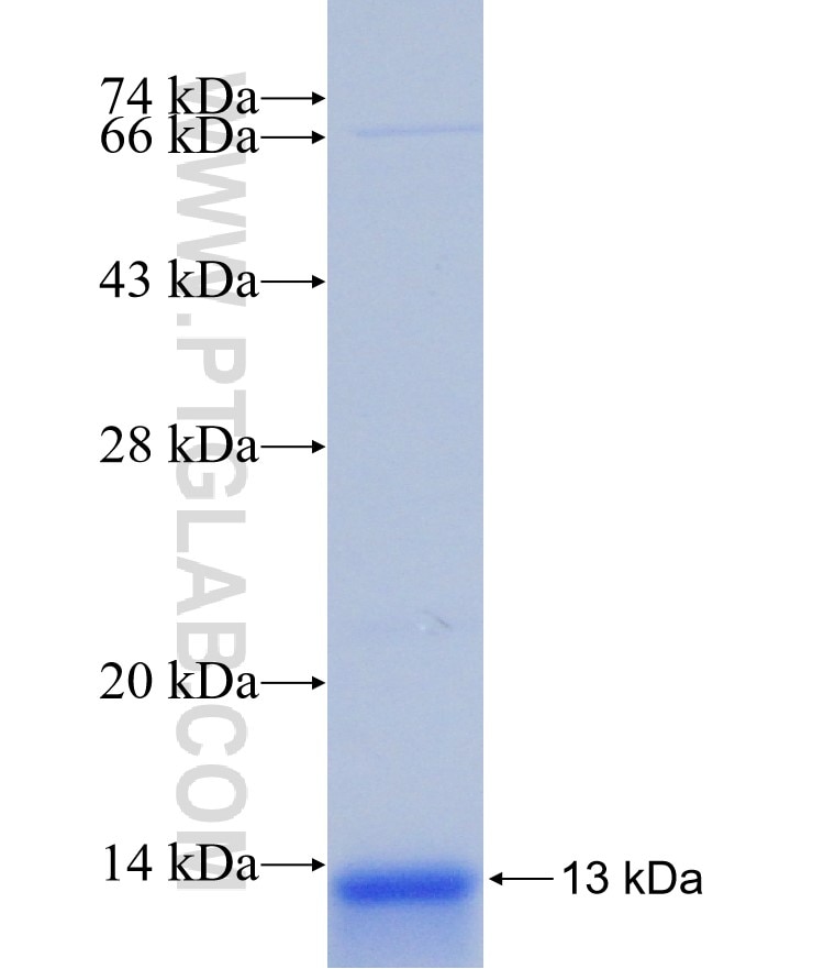 SERCA2,ATP2A2 fusion protein Ag30953 SDS-PAGE