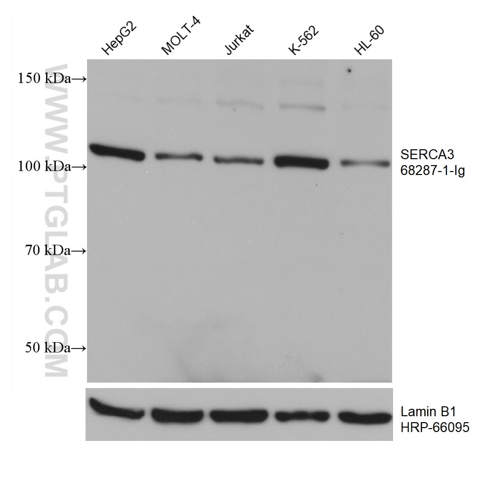 Western Blot (WB) analysis of various lysates using SERCA3 Monoclonal antibody (68287-1-Ig)