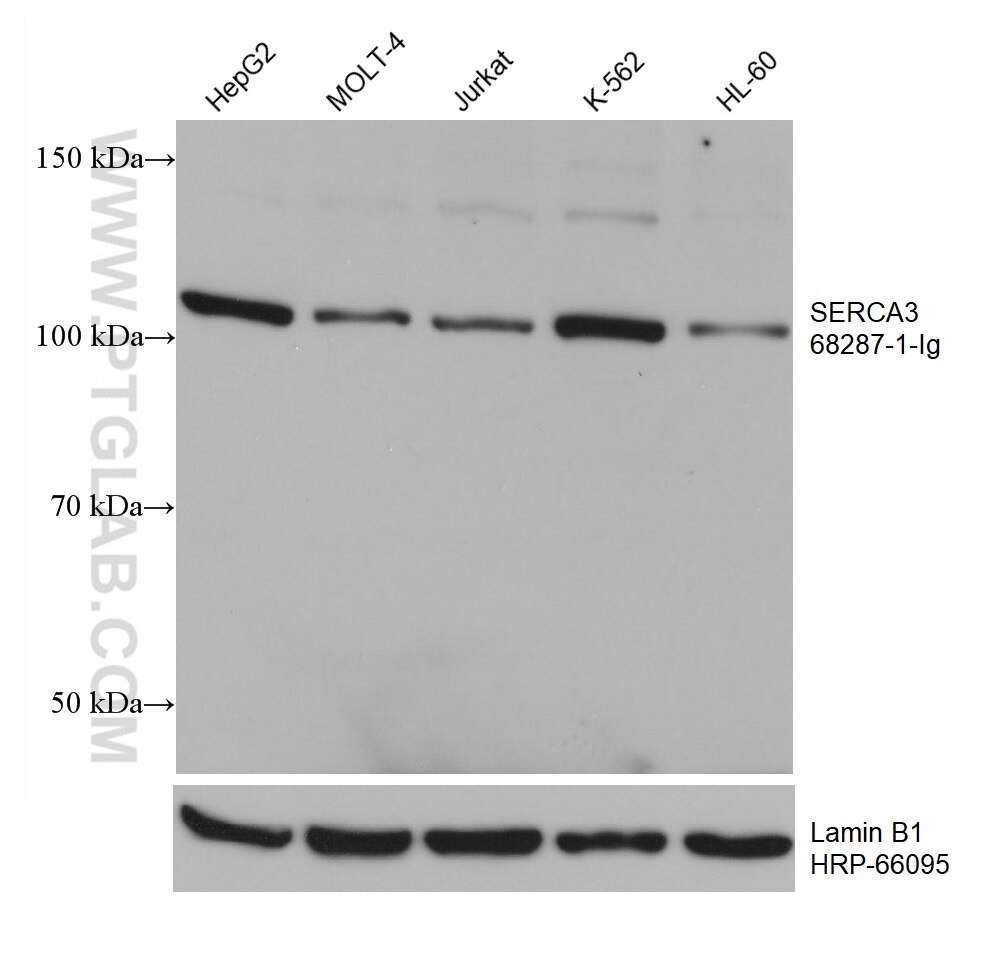 WB analysis using 68287-1-Ig