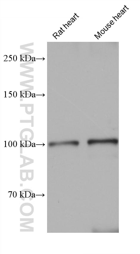 Western Blot (WB) analysis of various lysates using SERCA3 Monoclonal antibody (68287-1-Ig)