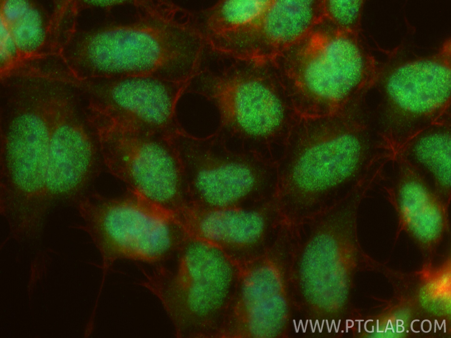 Immunofluorescence (IF) / fluorescent staining of HEK-293 cells using SERF1A Polyclonal antibody (12725-1-AP)