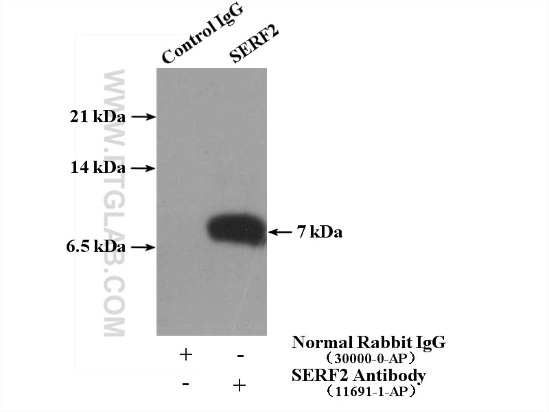 IP experiment of HepG2 using 11691-1-AP