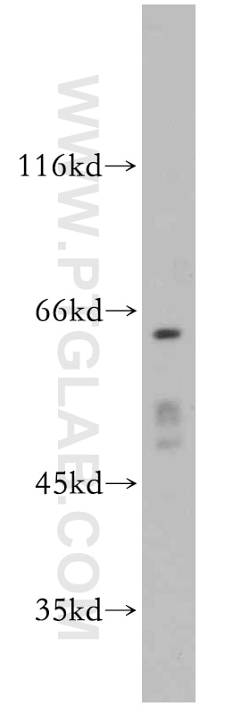 Western Blot (WB) analysis of HepG2 cells using SERINC1 Polyclonal antibody (20265-1-AP)