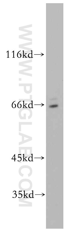 Western Blot (WB) analysis of MCF-7 cells using SERINC2-Specific Polyclonal antibody (20266-1-AP)