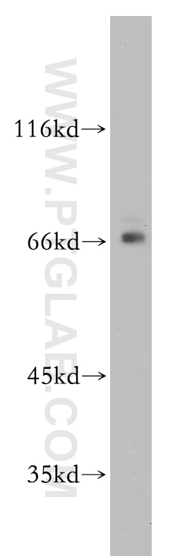 Western Blot (WB) analysis of HeLa cells using SERINC2-Specific Polyclonal antibody (20266-1-AP)