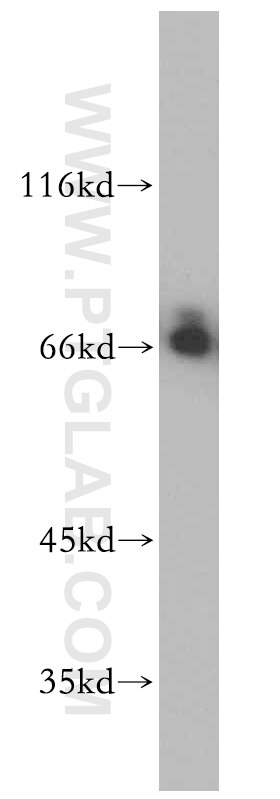 SERINC2-Specific