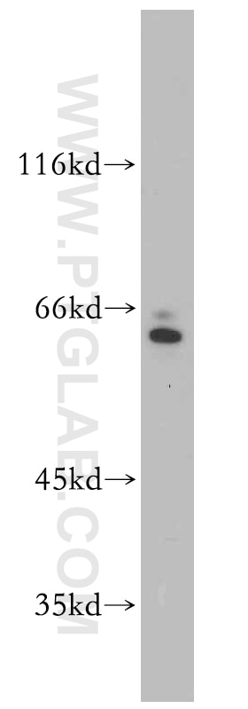 Western Blot (WB) analysis of HepG2 cells using SERINC2-Specific Polyclonal antibody (20266-1-AP)