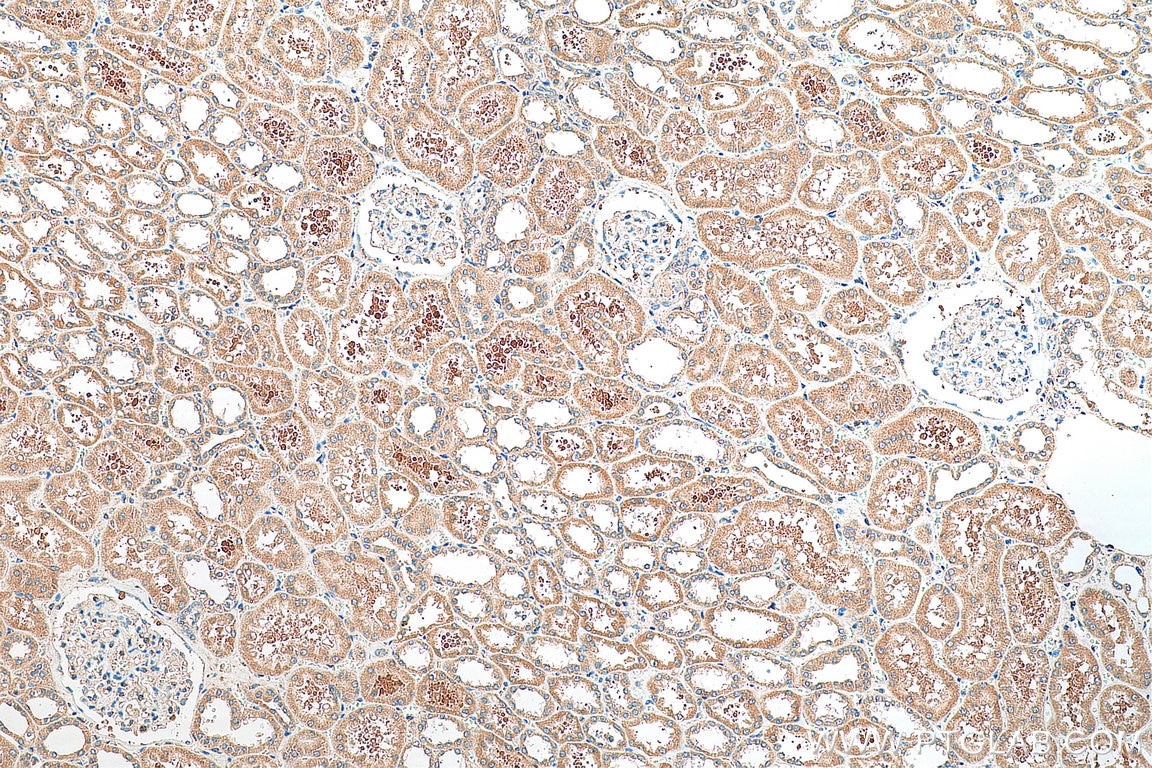 Immunohistochemistry (IHC) staining of human kidney tissue using SERINC3 Polyclonal antibody (20267-1-AP)