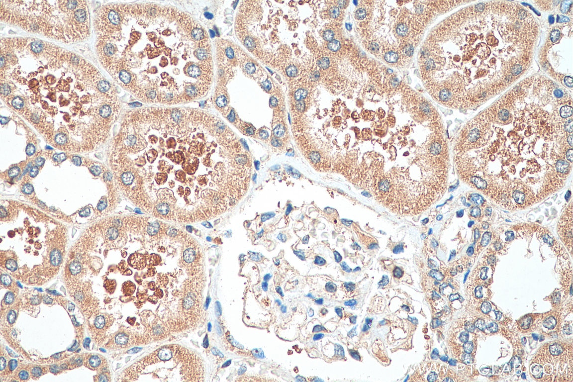 Immunohistochemistry (IHC) staining of human kidney tissue using SERINC3 Polyclonal antibody (20267-1-AP)