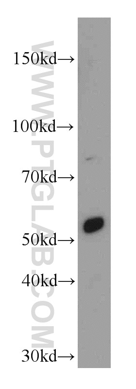 Western Blot (WB) analysis of mouse pancreas tissue using SERINC3 Polyclonal antibody (20267-1-AP)