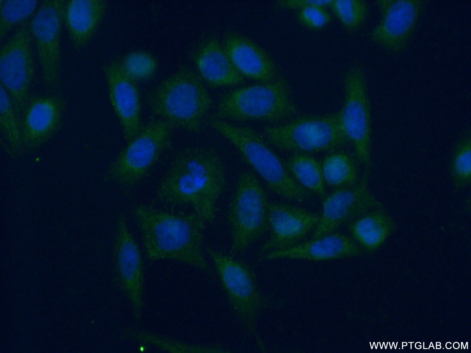 IF Staining of HeLa using 17807-1-AP