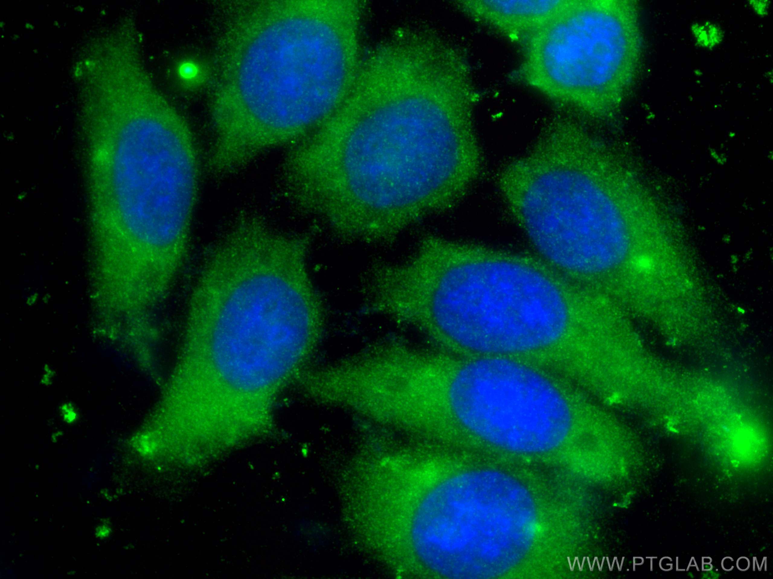 Immunofluorescence (IF) / fluorescent staining of HepG2 cells using Alpha 1 Antitrypsin Polyclonal antibody (16382-1-AP)