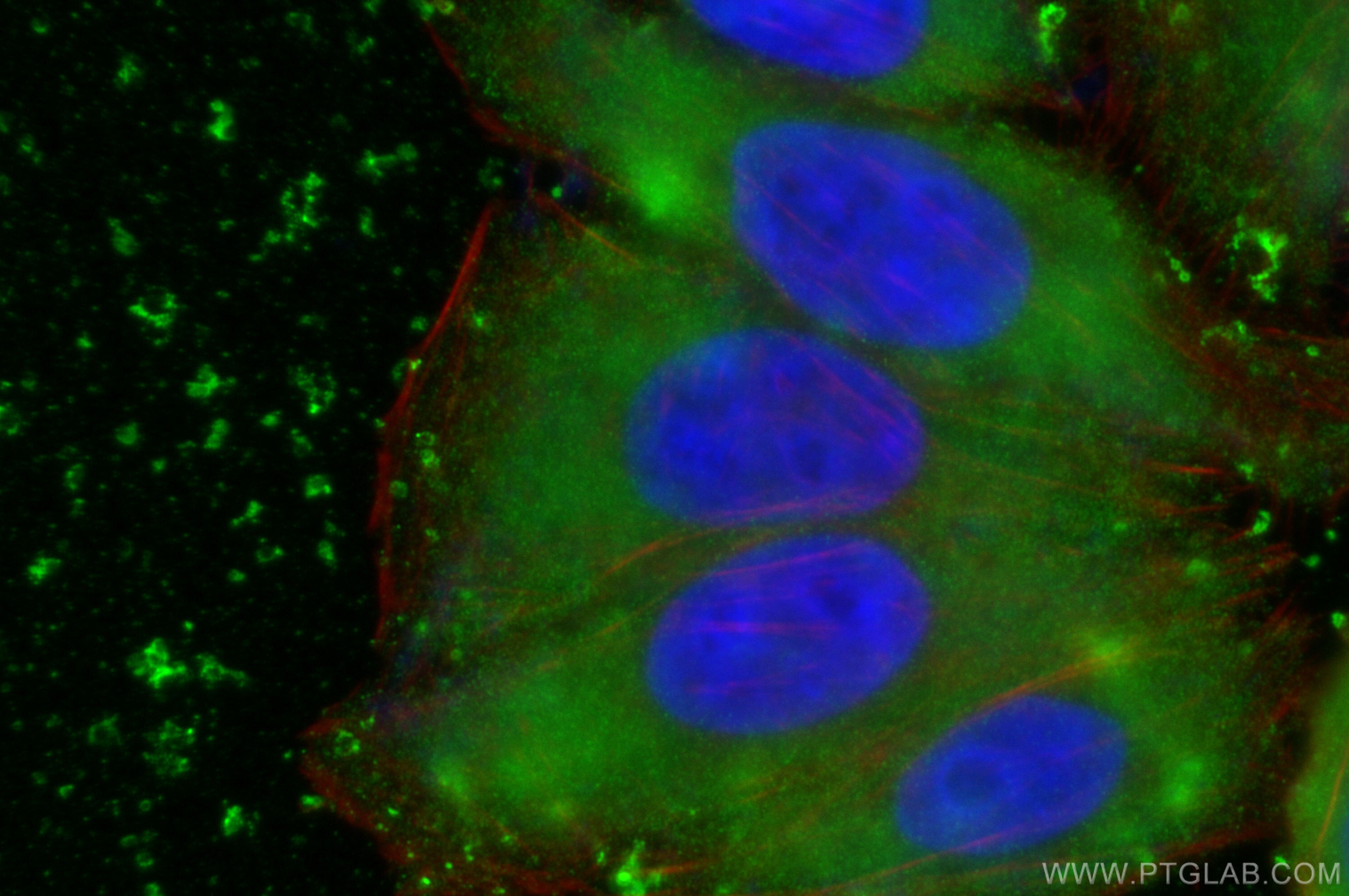 Immunofluorescence (IF) / fluorescent staining of HepG2 cells using Alpha 1 Antitrypsin Polyclonal antibody (16382-1-AP)