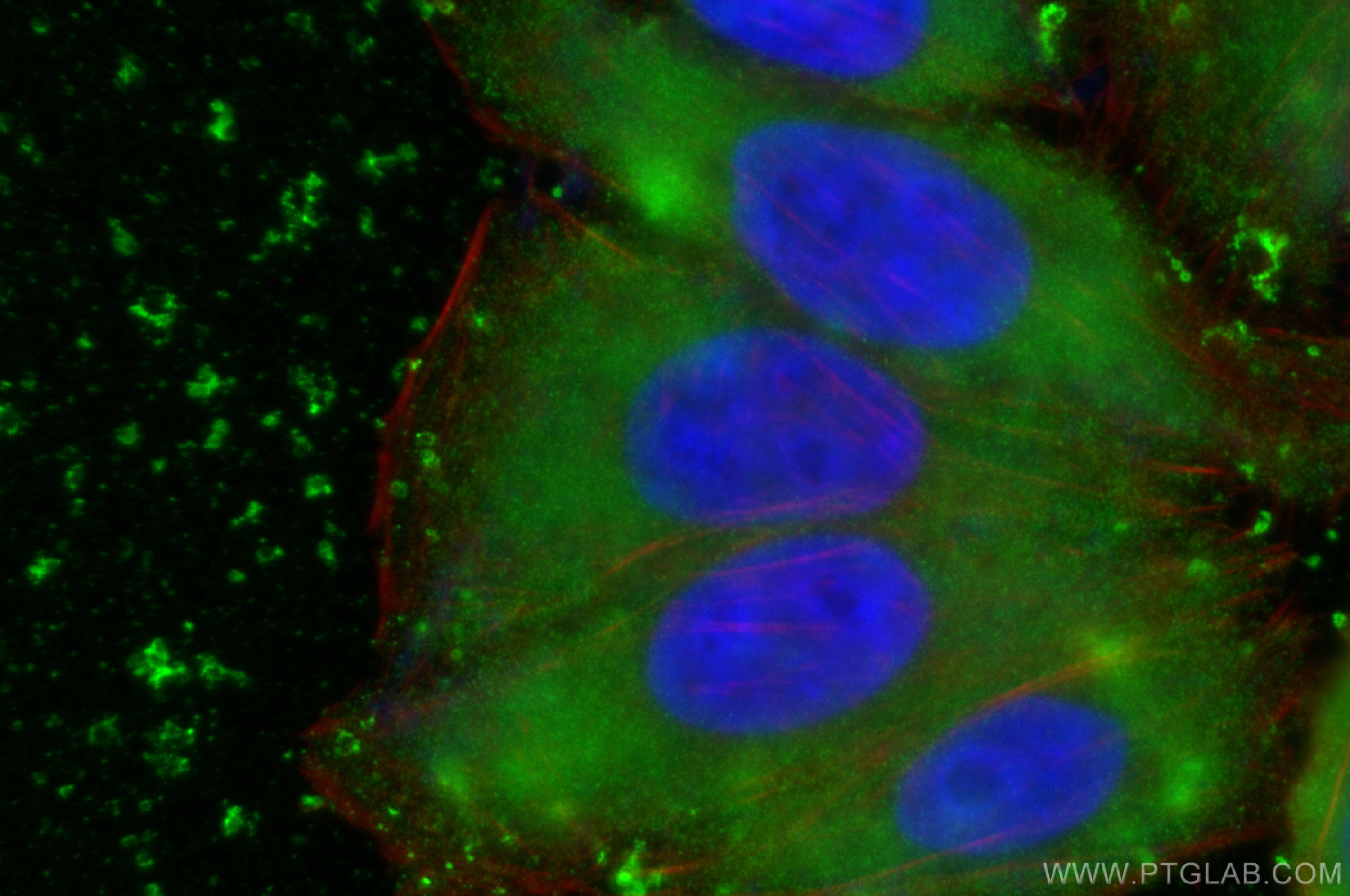 IF Staining of HepG2 using 16382-1-AP