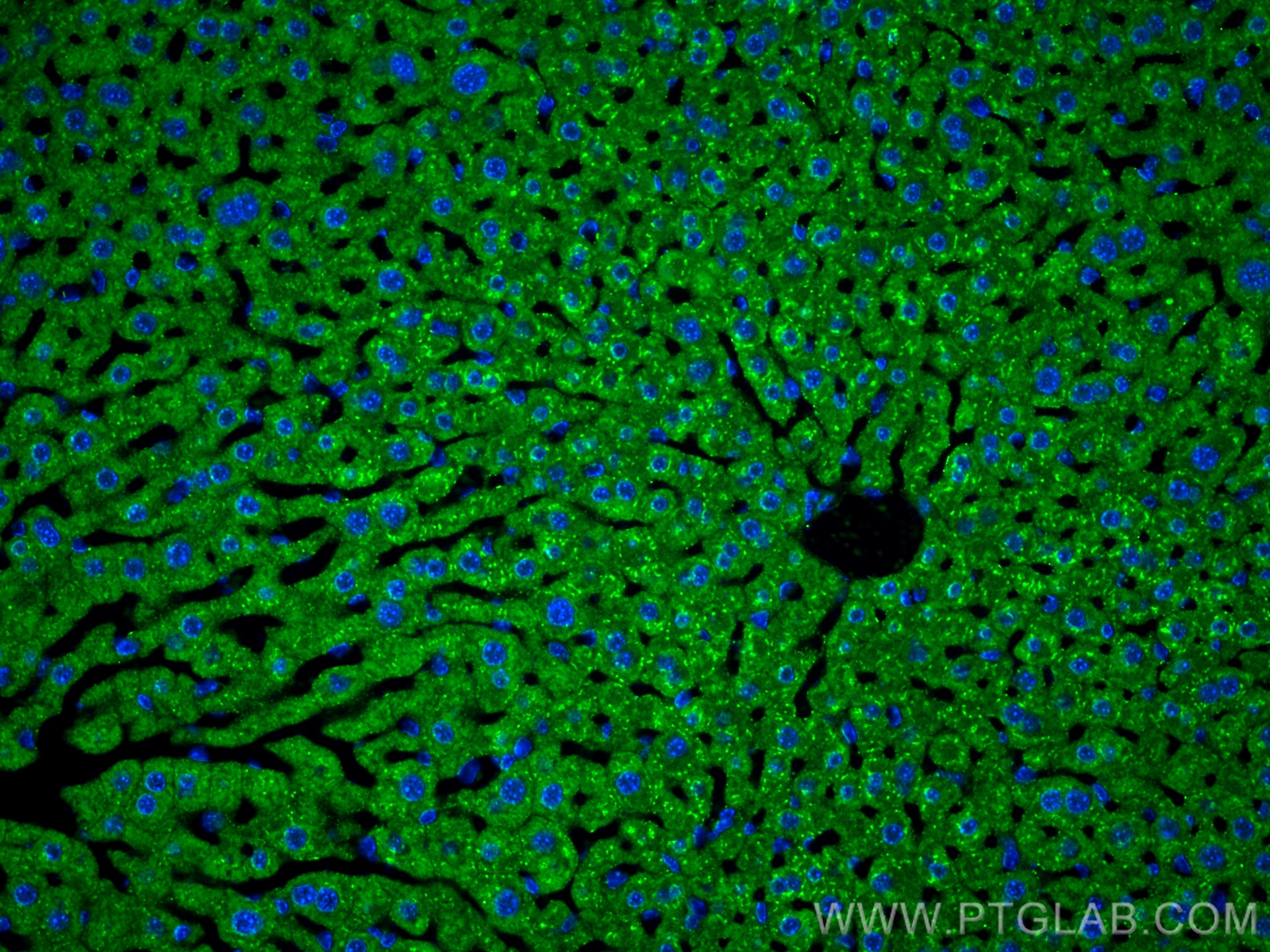 Immunofluorescence (IF) / fluorescent staining of mouse liver tissue using Alpha 1 Antitrypsin Polyclonal antibody (16382-1-AP)