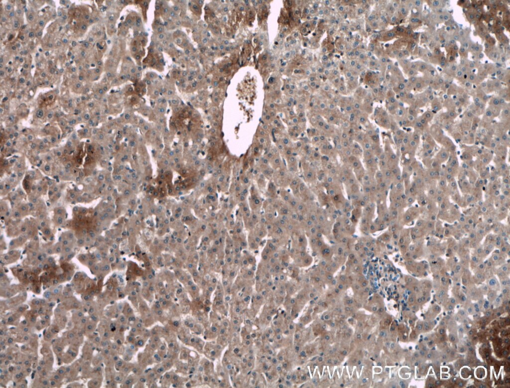 Alpha 1 Antitrypsin
