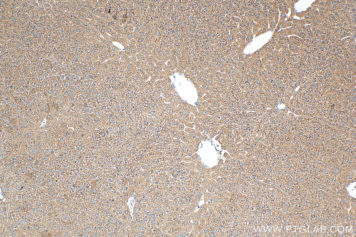 Immunohistochemistry (IHC) staining of mouse liver tissue using Alpha 1 Antitrypsin Polyclonal antibody (16382-1-PBS)