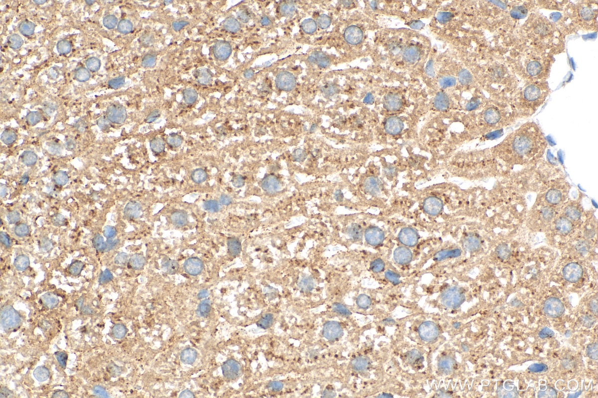 Immunohistochemistry (IHC) staining of mouse liver tissue using Alpha 1 Antitrypsin Polyclonal antibody (16382-1-PBS)