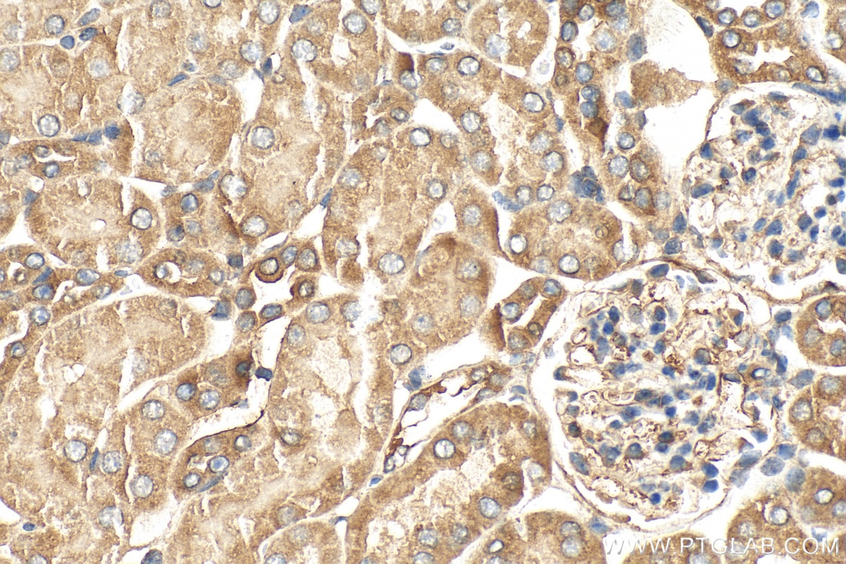 Immunohistochemistry (IHC) staining of mouse kidney tissue using Alpha 1 Antitrypsin Polyclonal antibody (16382-1-AP)