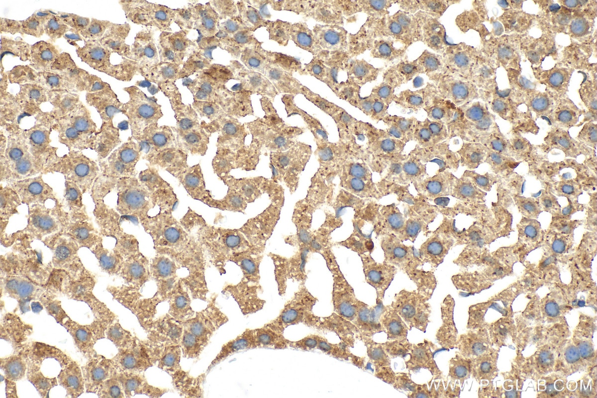 Immunohistochemistry (IHC) staining of mouse liver tissue using Alpha 1 Antitrypsin Polyclonal antibody (16382-1-AP)