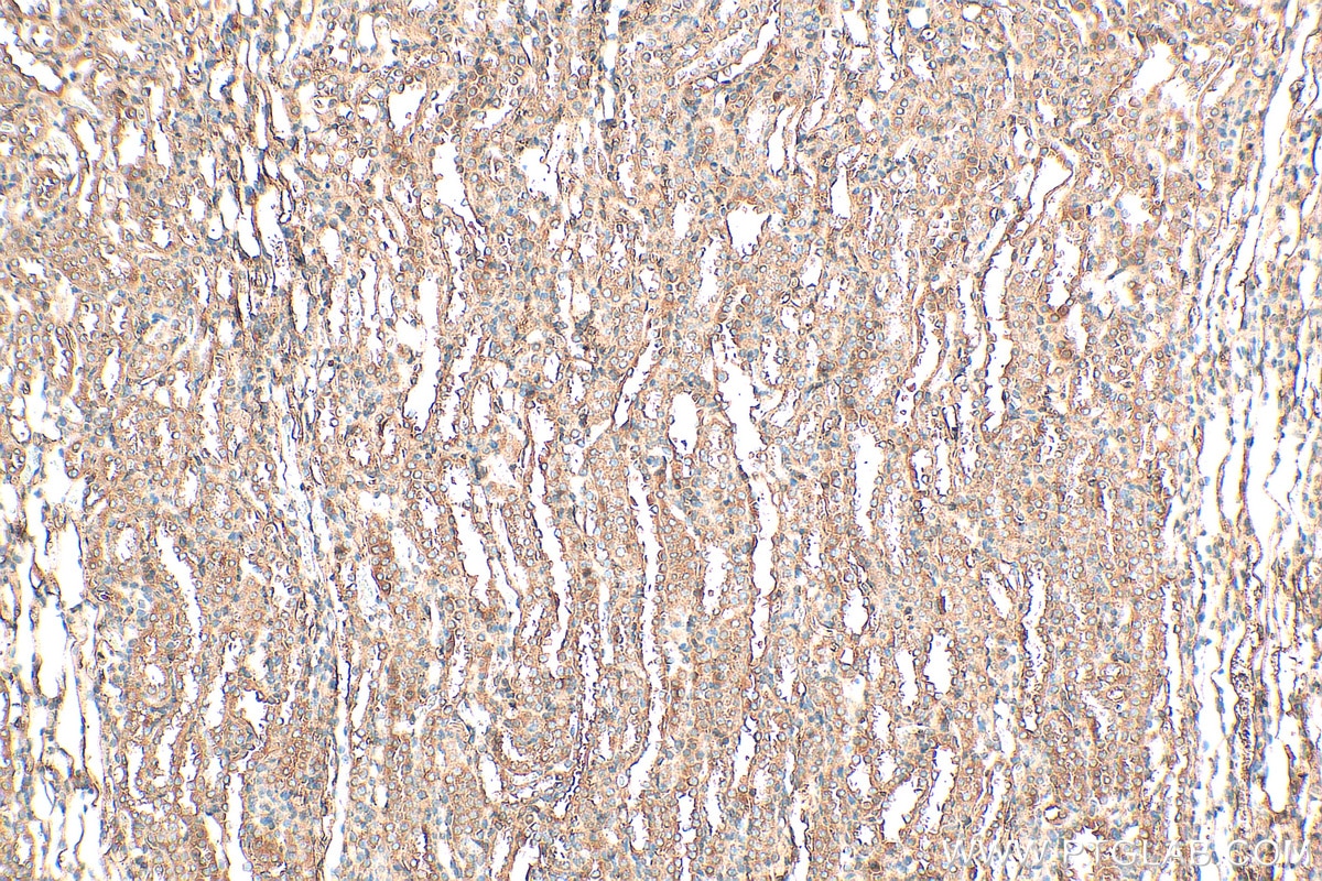 Immunohistochemistry (IHC) staining of rat kidney tissue using Alpha 1 Antitrypsin Polyclonal antibody (16382-1-AP)