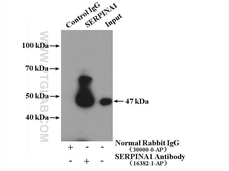 Immunoprecipitation (IP) experiment of mouse kidney tissue using Alpha 1 Antitrypsin Polyclonal antibody (16382-1-AP)
