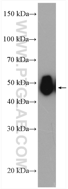 Western Blot (WB) analysis of human urine sample using Alpha 1 Antitrypsin Polyclonal antibody (16382-1-AP)