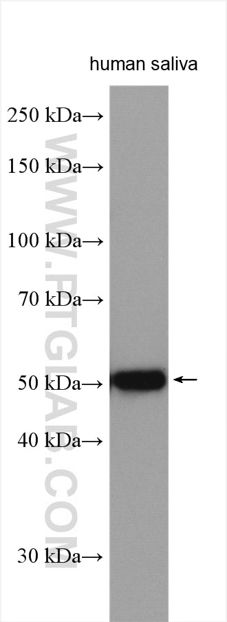 Western Blot (WB) analysis of various lysates using Alpha 1 Antitrypsin Polyclonal antibody (16382-1-AP)