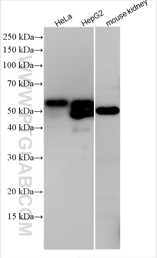 Western Blot (WB) analysis of various lysates using Alpha-1-Antitrypsin Polyclonal antibody (16382-1-AP)