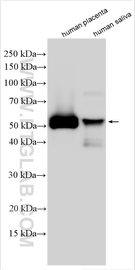 Western Blot (WB) analysis of various lysates using Alpha-1-Antitrypsin Polyclonal antibody (16382-1-AP)
