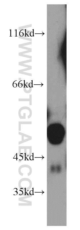 Western Blot (WB) analysis of human kidney tissue using Alpha 1 Antitrypsin Polyclonal antibody (16382-1-AP)