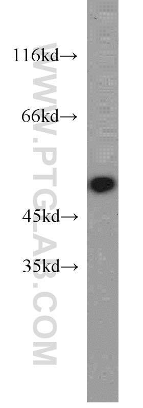 Western Blot (WB) analysis of mouse skin tissue using Alpha 1 Antitrypsin Polyclonal antibody (16382-1-AP)