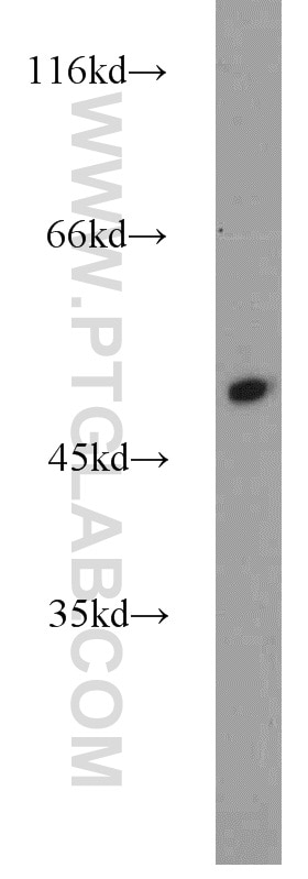 Western Blot (WB) analysis of mouse kidney tissue using Alpha 1 Antitrypsin Polyclonal antibody (16382-1-AP)