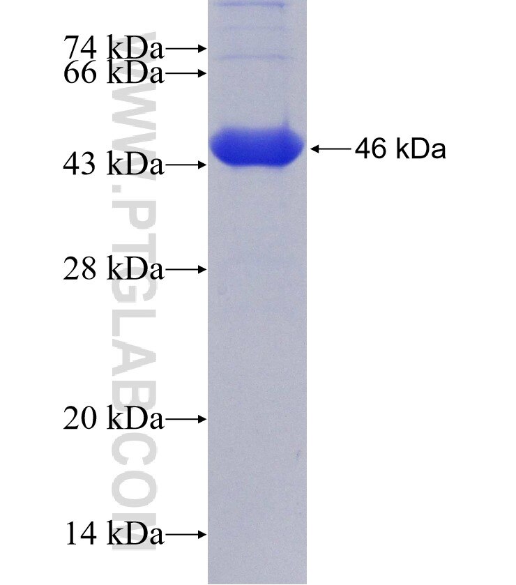 Alpha-1-Antitrypsin fusion protein Ag9516 SDS-PAGE