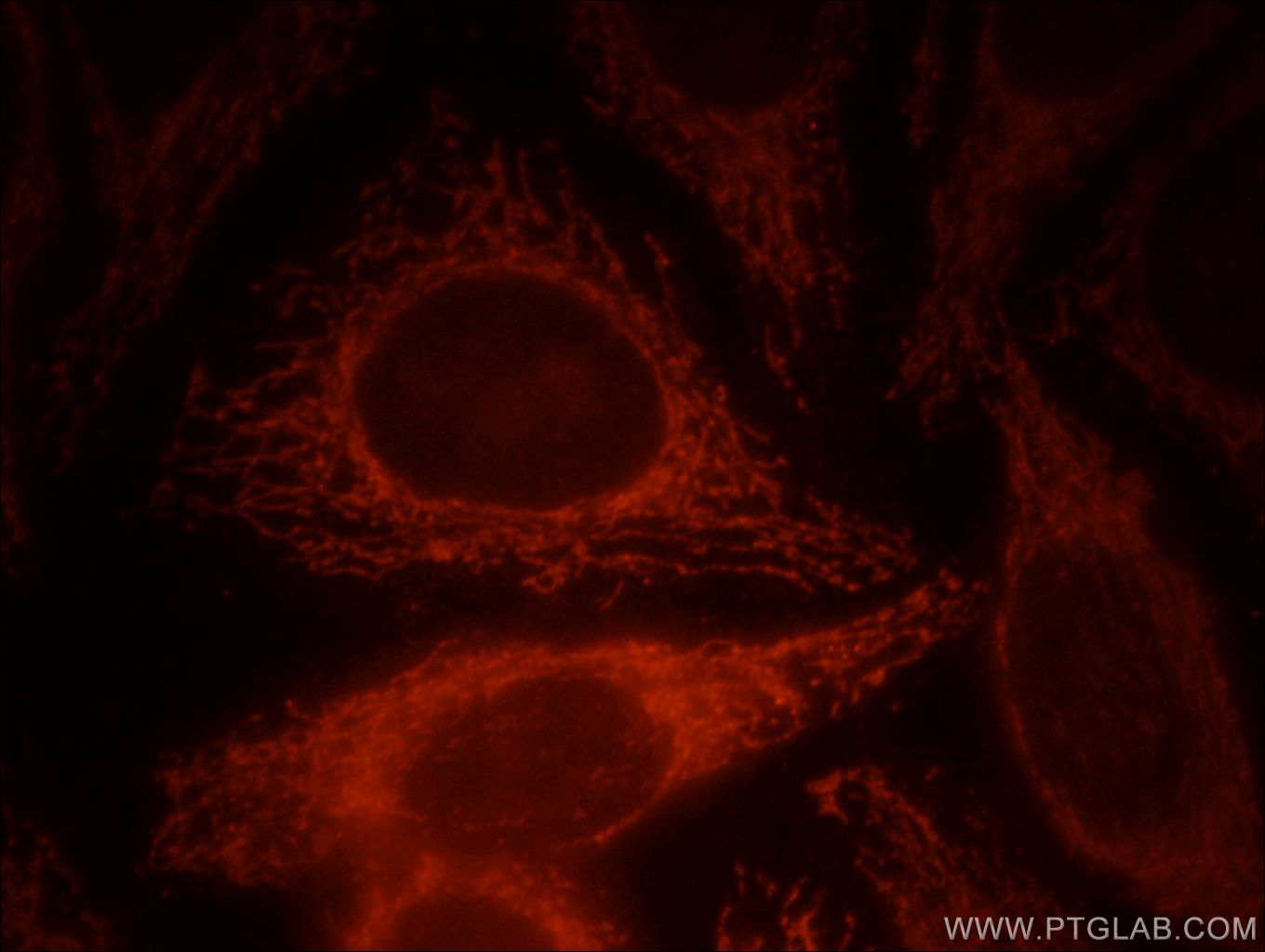 IF Staining of HepG2 using 11851-1-AP