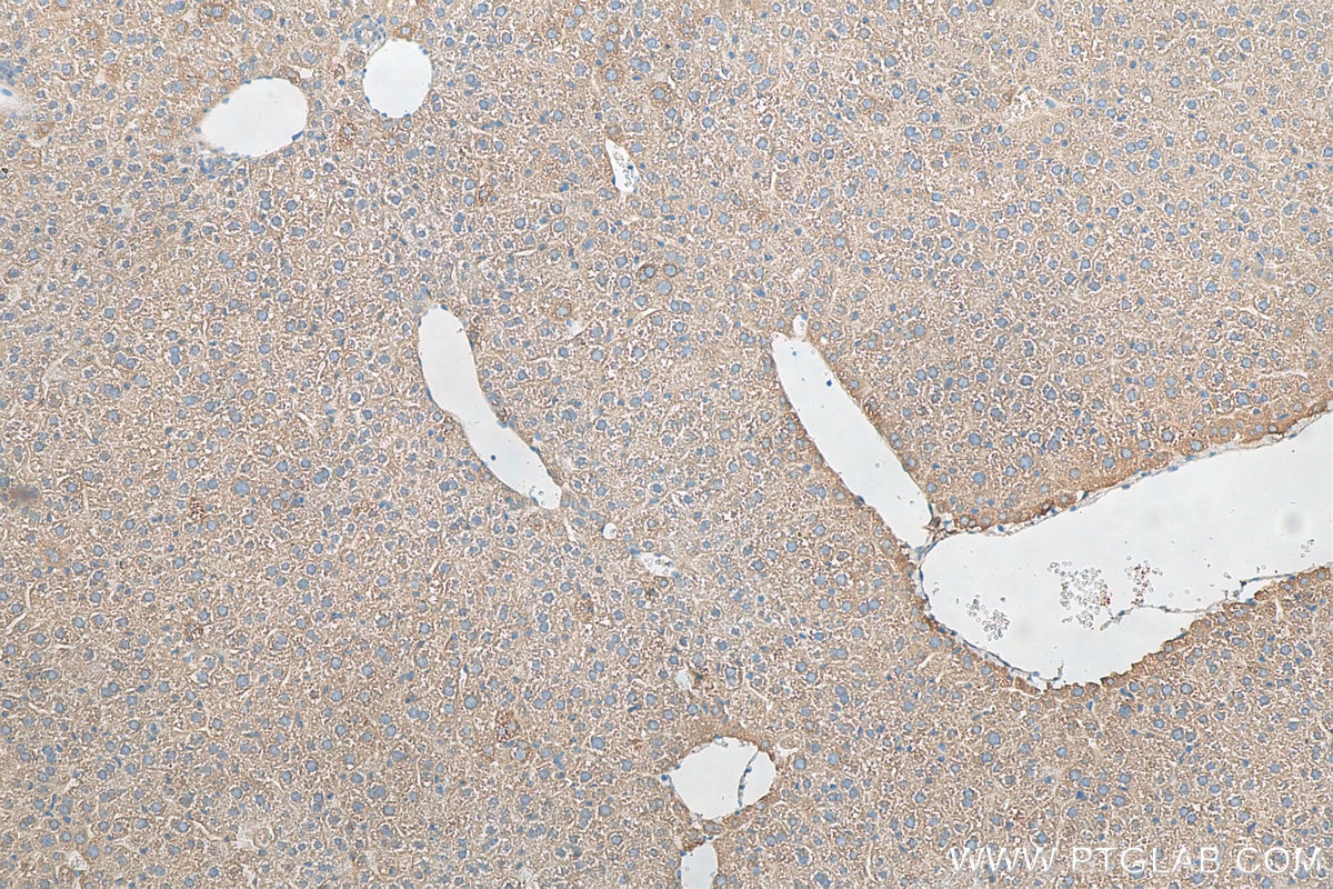 IHC staining of mouse liver using 11851-1-AP