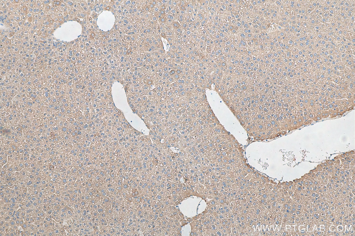 Immunohistochemistry (IHC) staining of mouse liver tissue using SERPINA10 Polyclonal antibody (11851-1-AP)