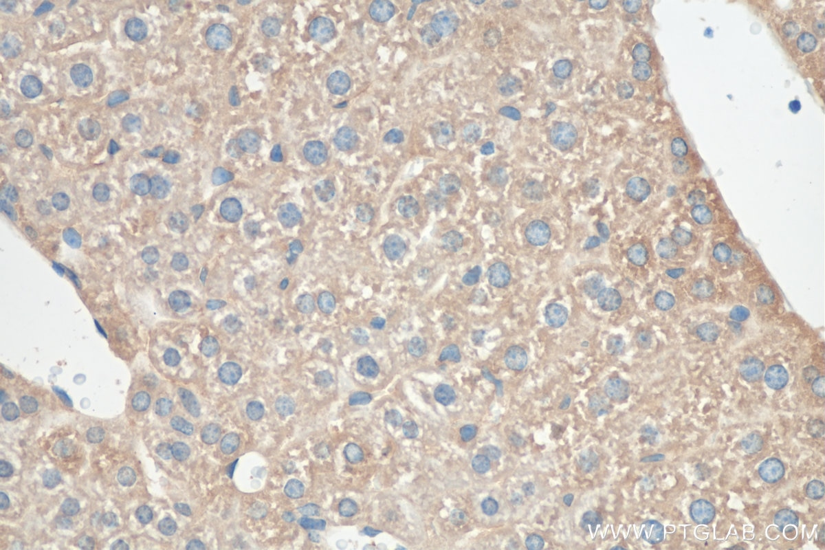 Immunohistochemistry (IHC) staining of mouse liver tissue using SERPINA10 Polyclonal antibody (11851-1-AP)