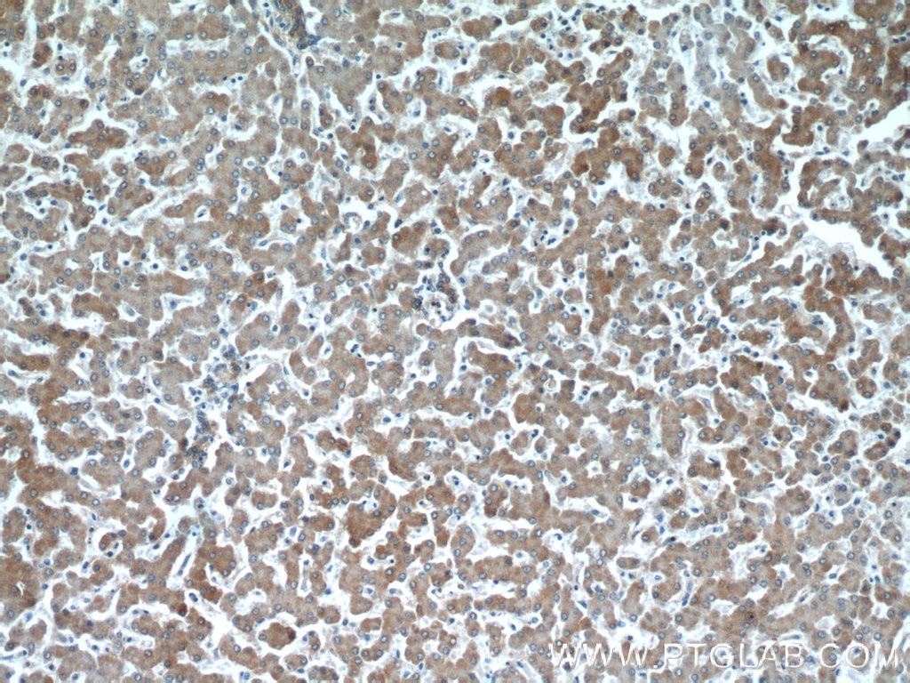 IHC staining of human liver using 11851-1-AP